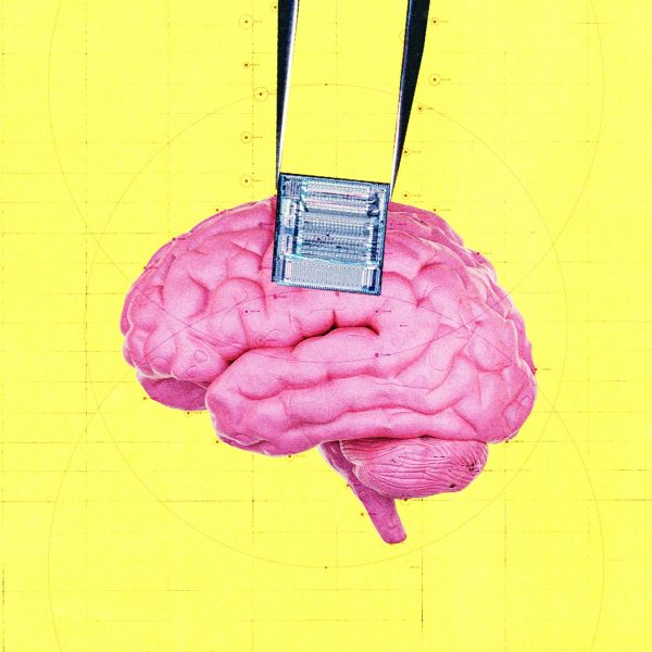OpenAI Investasi ke Startup Implan Otak untuk Deteksi Cancer